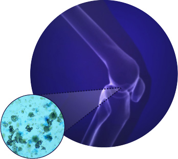 Cellular view of cartilage with knee bone